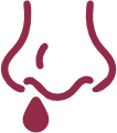 Cauterização nasal - Clínica médica Otorrinolaringologista Dra Sarah Cristina Beirith.